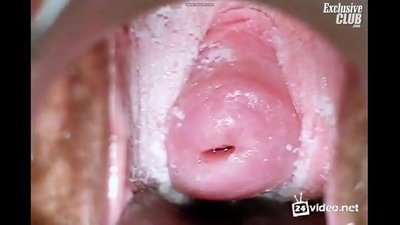 एक सुन्दर महिला को Gynecological परीक्षा